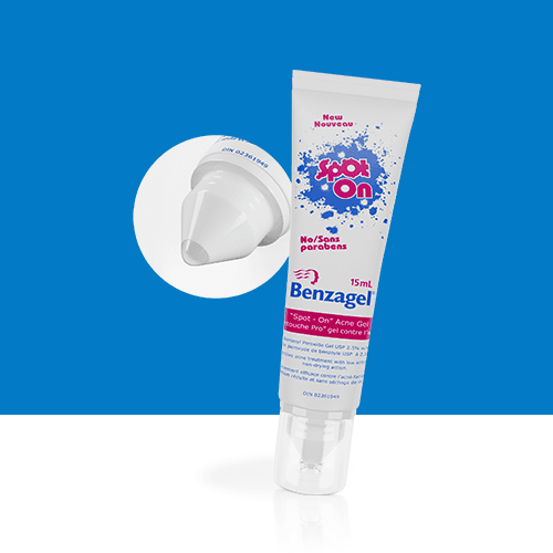 Spot On Acne Spot Treatment