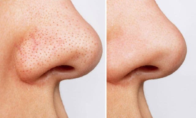 carousel