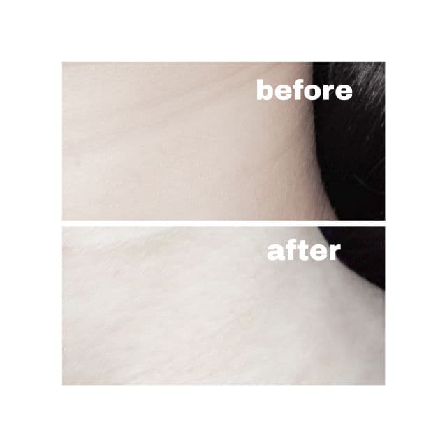 carousel