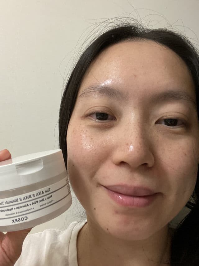 COSRX No Spot Left Behind review photo by NguyenAndOngLy
