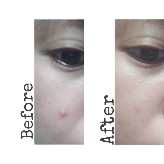 COSRX The Niacinamide 15 Serum review photo by Apweel