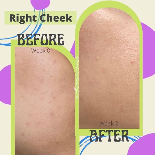 By WISHTREND Vitamin A-mazing Bakuchiol Night Cream review photo by treasuredbeautyfinds