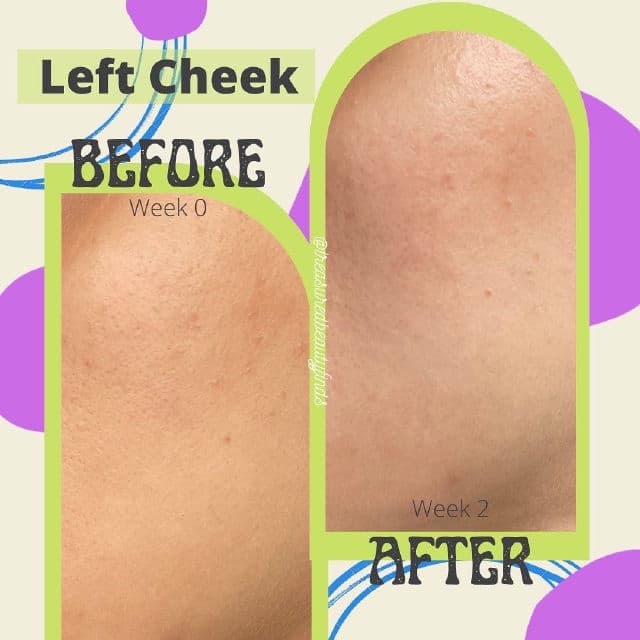 By WISHTREND Vitamin A-mazing Bakuchiol Night Cream review photo by treasuredbeautyfinds