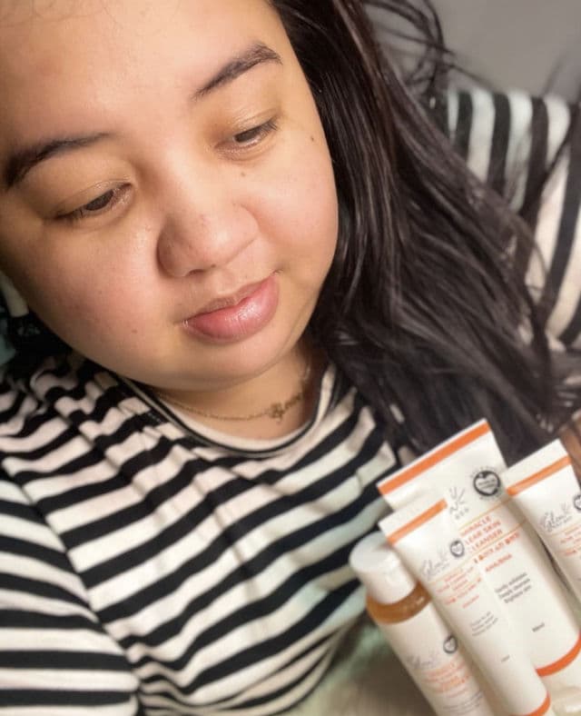 Hello Glow Blemish Miracle Set - Cream review photo by chweetsays