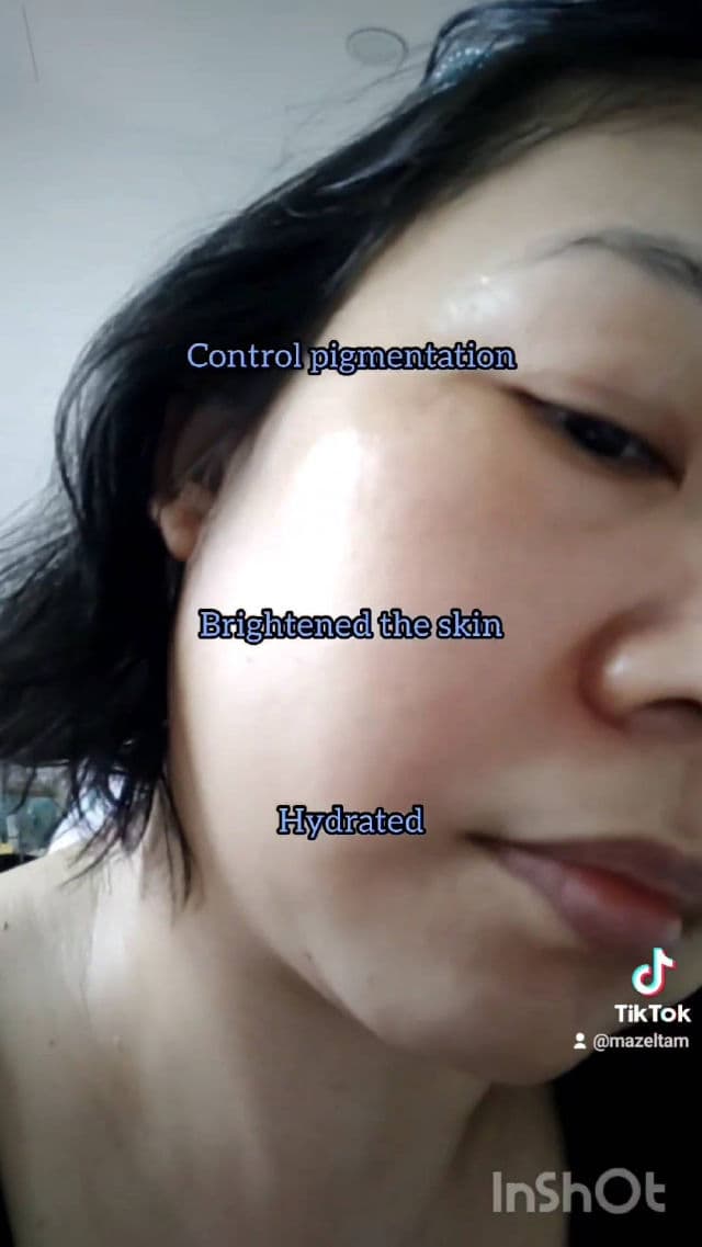PAPA RECIPE Niacinamide Zinc Serum review photo by mazeltam