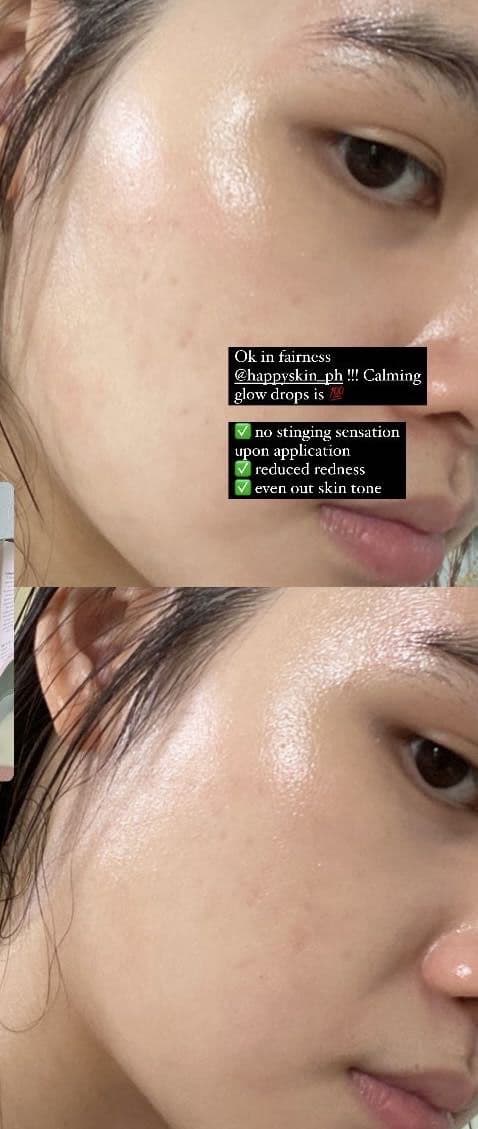 Happy Skin Calming Glow Drops review photo by ssffolskin