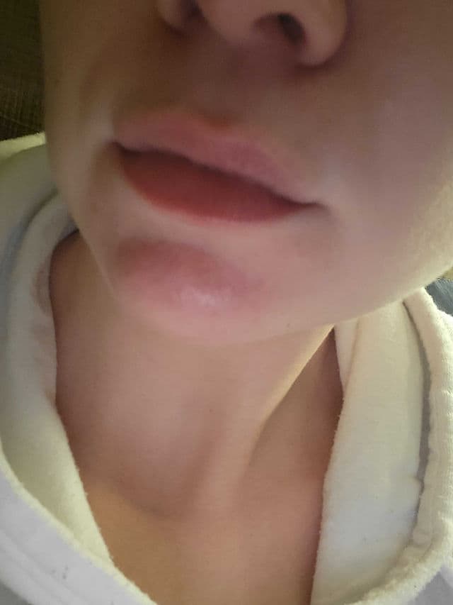 Clinique Moisture Surge Pop Triple Lip Balm review photo by NatRose