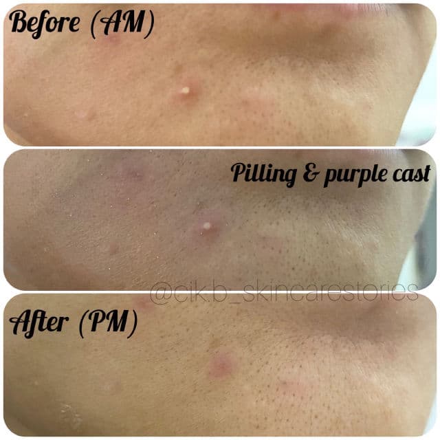 Daughters of Malaya Sulfur Spot Drying Lotion review photo by cikbskincarestories