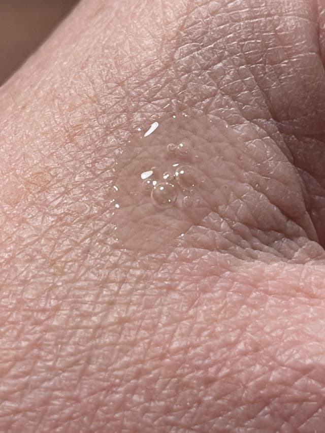P.CALM Porsica Ampoule review photo by Mannika