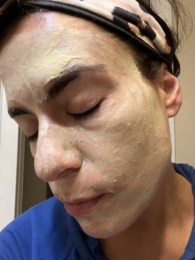 HANSKIN Vitamin C Glow Mask review photo by DrJEM