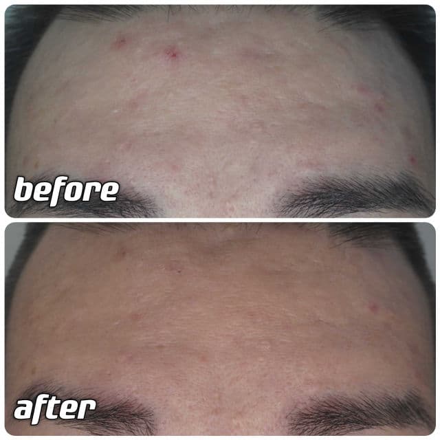 RAVIEL Acerola Dark Spot & Blemish Care Cream review photo by danielwonderland