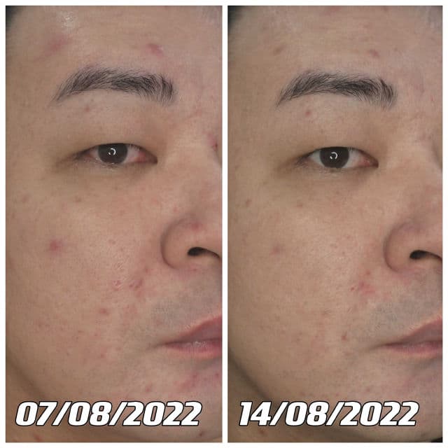 whitelab Intense Brightening Serum Niacinamide 10% + Collagen review photo by danielwonderland