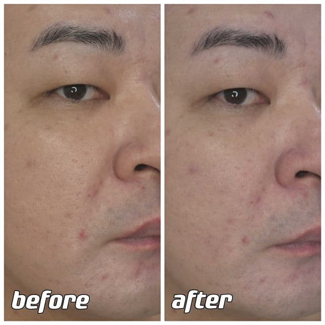 Beauty Buffet Scentio Milk Plus Whitening Facial Foam review photo by danielwonderland