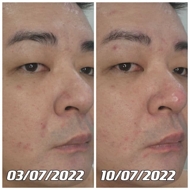 Pyunkang Yul Black Tea Enriched Cream review photo by danielwonderland