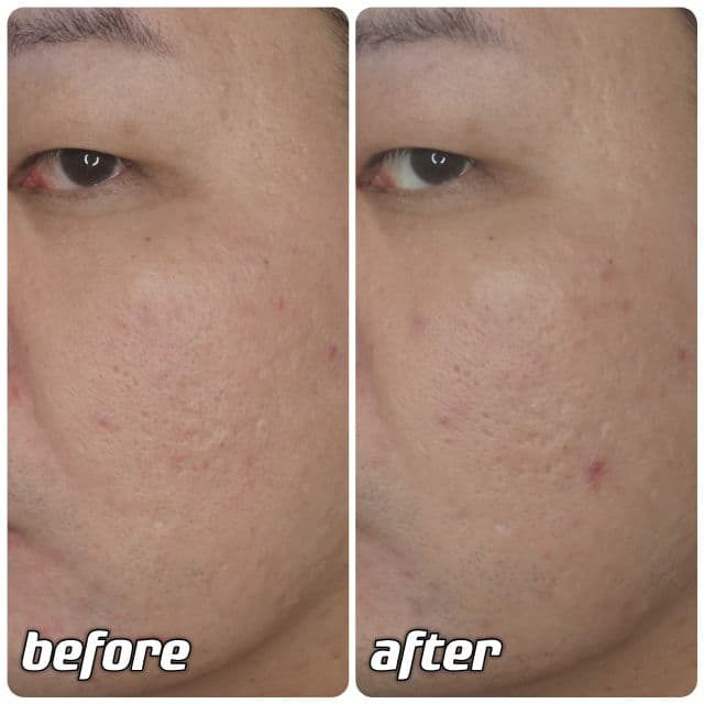 SKIN&LAB Vitamin B Hydrating Gel Cream review photo by danielwonderland