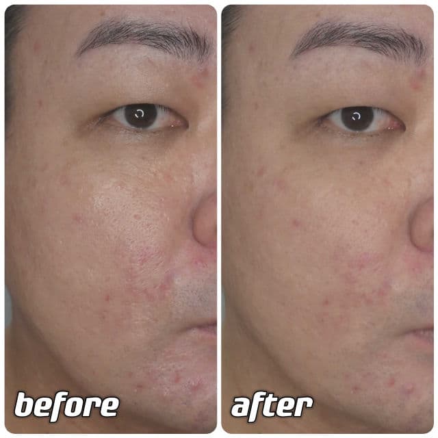 Beplain Mung Bean Pore Clay Mask review photo by danielwonderland