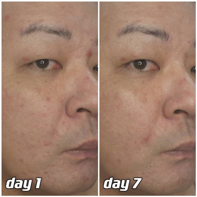 BENTON Heartleaf Cream review photo by danielwonderland