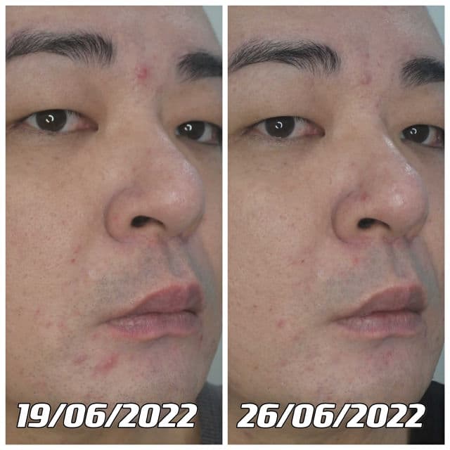 Pureforet Centella Multi Cream review photo by danielwonderland