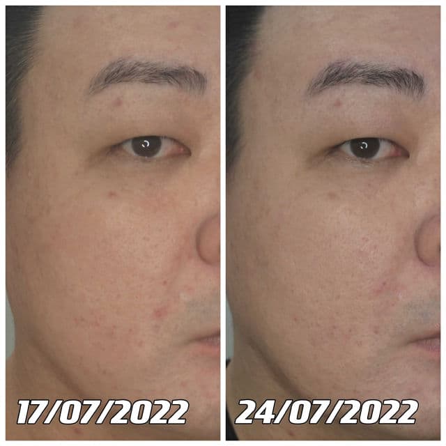 Bellflower Alpha Arbutin Cream for Brightening review photo by danielwonderland