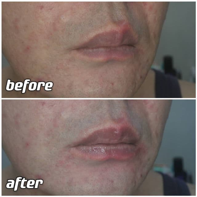 belif Super Knights Multi Vitamin Lipcerin  review photo by danielwonderland