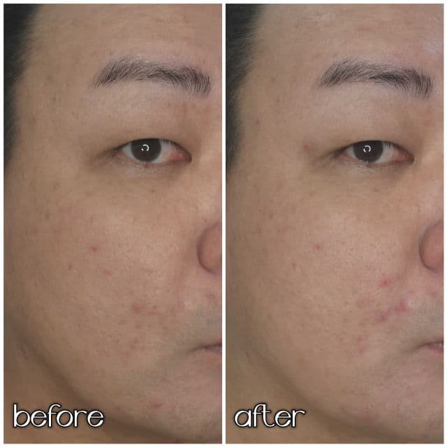 One-day's you Cica:ming Cream review photo by danielwonderland