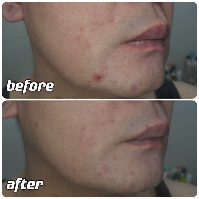 Aestura Atobarrier 365 Lotion review photo by danielwonderland