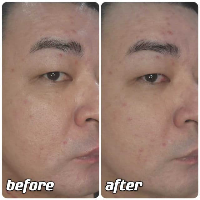 Beplain Cicaful Calming Clay Mask review photo by danielwonderland