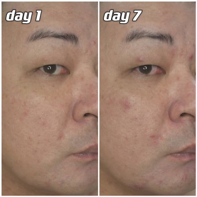 P.CALM Retinolagen Ampoule review photo by danielwonderland
