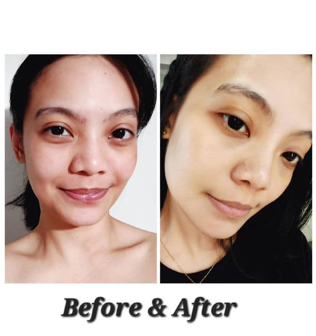 Kiehl's Truly Targeted Acne-Clearing Solution with Salicylic Acid review photo by Soojin