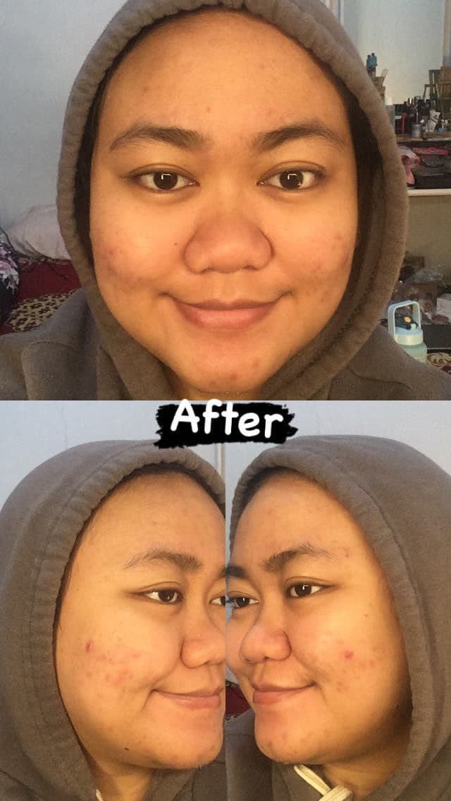 Nacific Fresh Cica Plus Clear Toner review photo by farahaszar