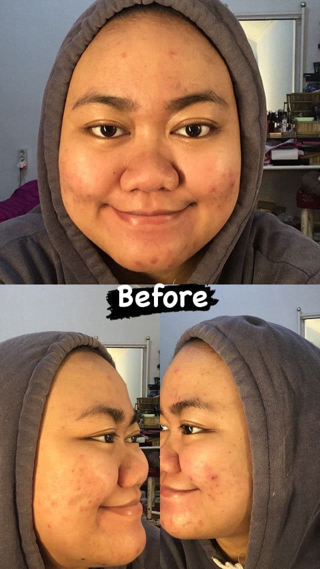 Nacific Fresh Cica Plus Clear Cream review photo by farahaszar