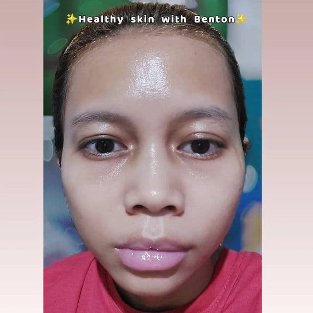 BENTON Bakuchiol Serum review photo by luaeiv
