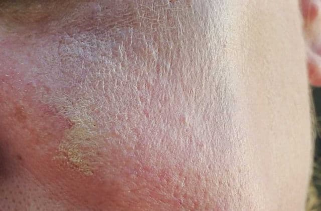 Supergoop! CC Screen 100% Mineral CC Cream SPF 50 review photo by SarriK