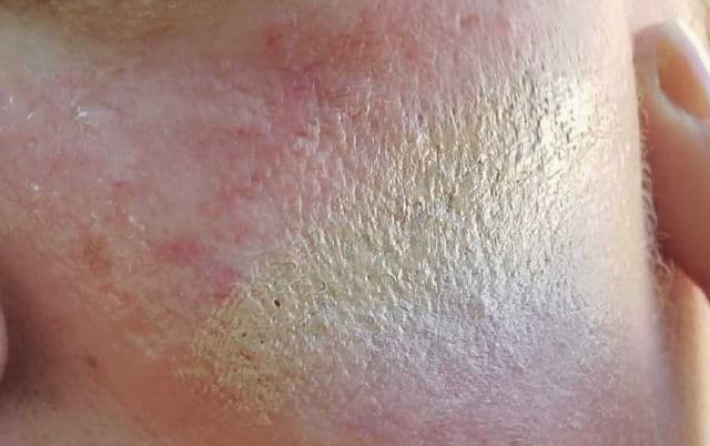 Supergoop! CC Screen 100% Mineral CC Cream SPF 50 review photo by SarriK