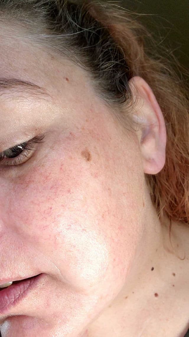 YEOUTH Retinol Serum Hyaluronic Acid Vitamin E Aloe Vera review photo by SarriK