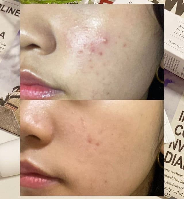 CHIYOU Sucral Overnight Solution Cream review photo by shaooo