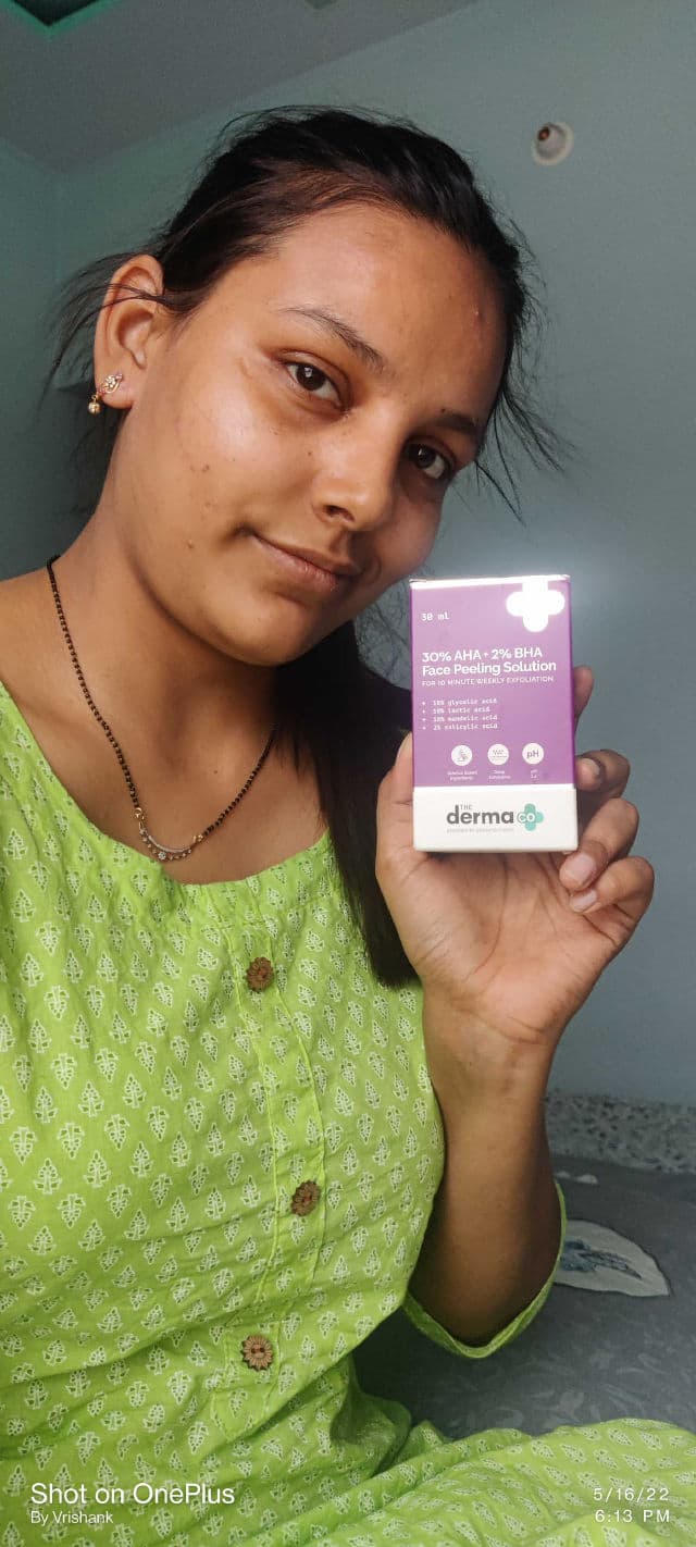 The Derma Co. 30% AHA + 2% BHA Peeling Solution review photo by AwesomeVK