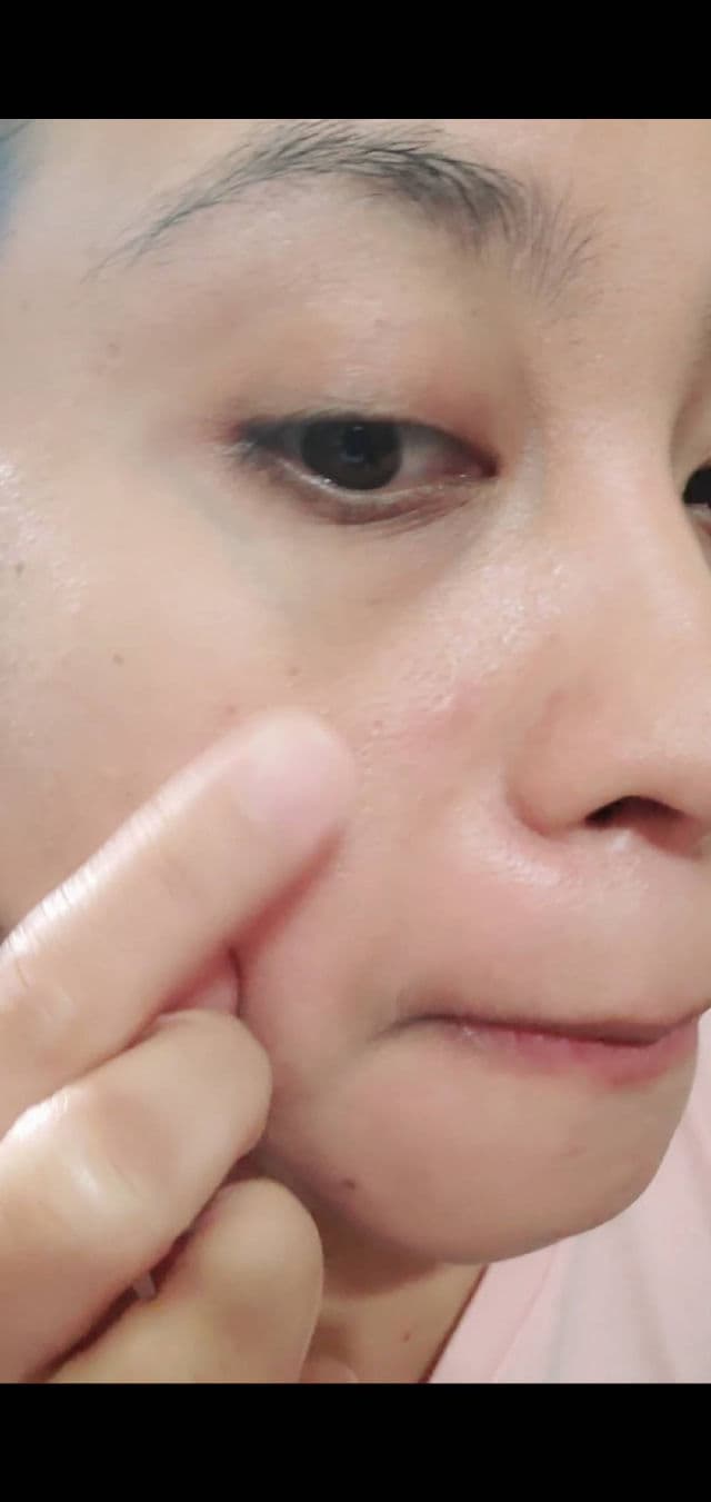 Glam Up Spotless Wide Patch review photo by Nhaty