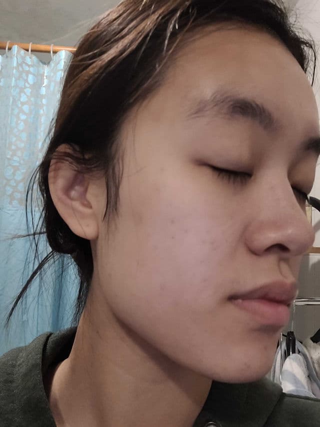 COMMONLABS Vitamin E Calming Ampoule review photo by clumpsymai