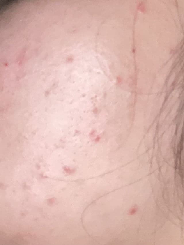GOODAL Houttuynia Cordata Calming Moisture Cream review photo by moonandmeow