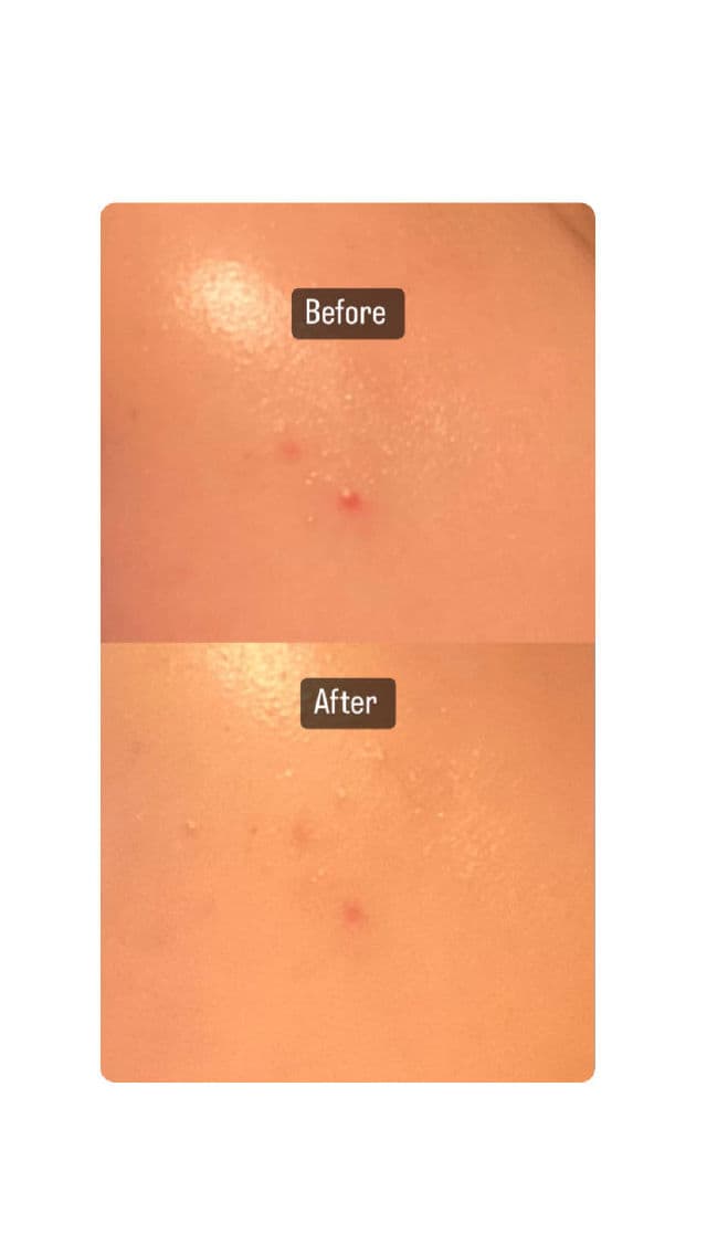 CELIMAX The Real Cica Soothing Cream  review photo by Kaiiixx