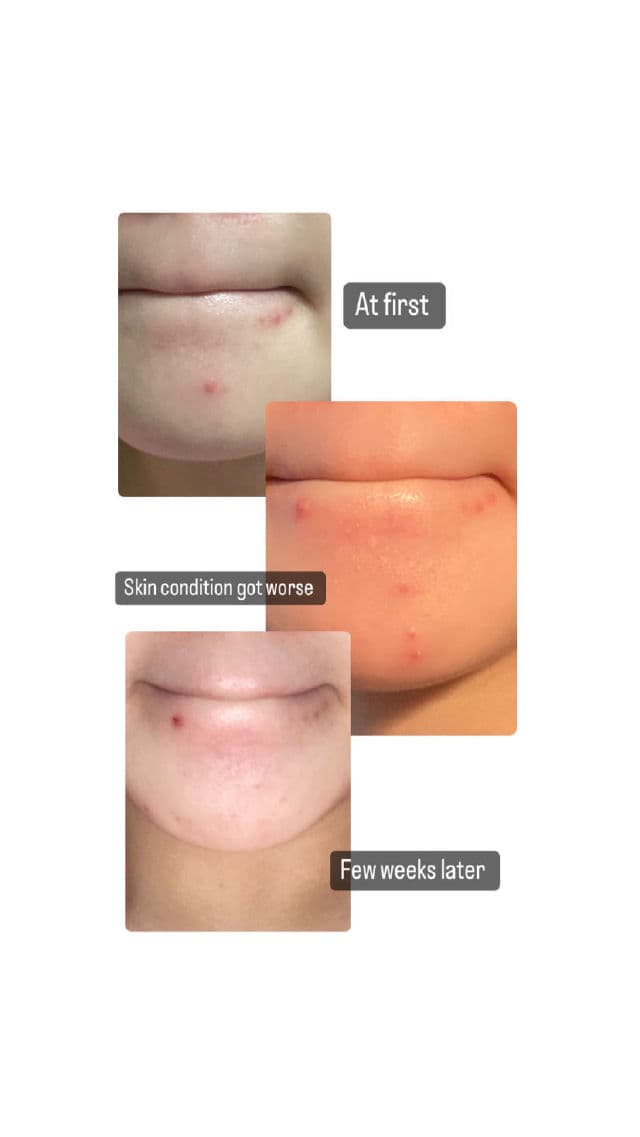 CELIMAX The Real Cica Soothing Cream  review photo by Kaiiixx