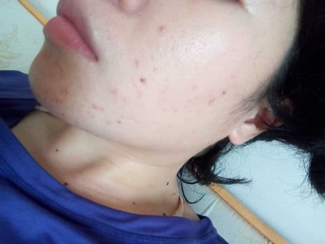 SCINIC Cicanoid Ampoule review photo by WondaDonda