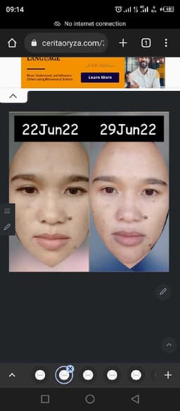 review