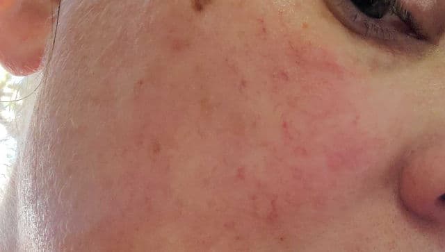 Hue Calm Waterful Refining Toner Pads review photo by Cade