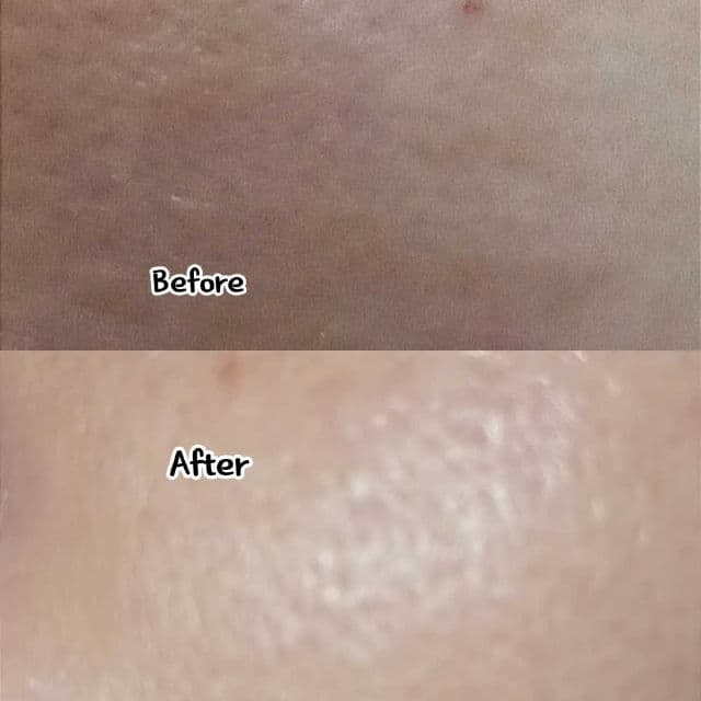 UnderPore Foam Cleanser product review