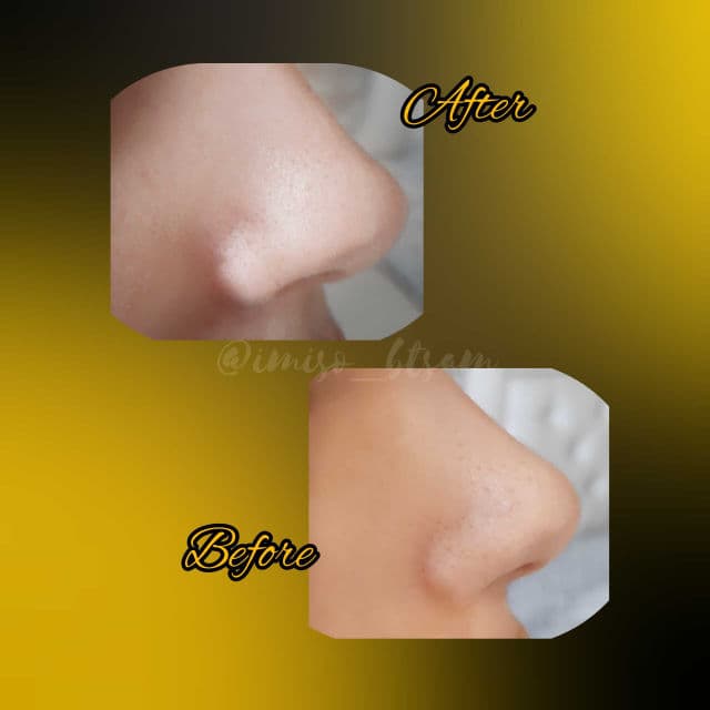 TIAM Blackhead Out Sheet review photo by Imisobtsam