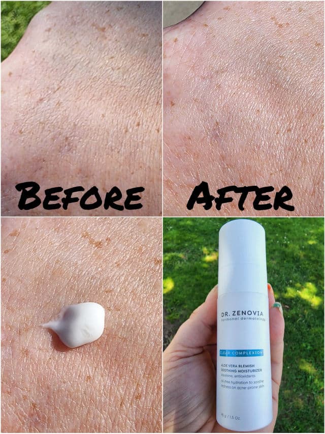 Dr. Zenovia Aloe Vera Blemish Soothing Moisturizer review photo by Researching4Beauty