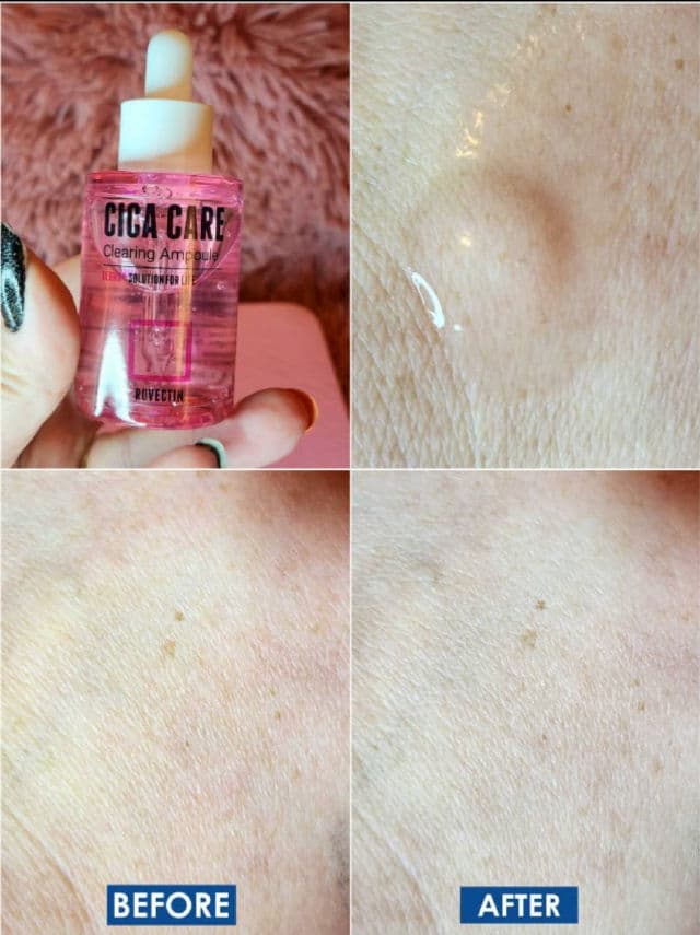 Skin Essentials Cica Care Clearing Ampoule product review