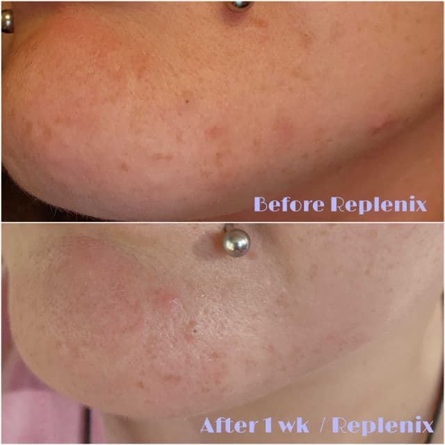 Replenix Anti-Aging Retinol 5x Regenerate Dry Serum review photo by Researching4Beauty
